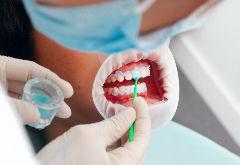 Dentist performing Tooth Cleaning Before Cosmetic Dentistry Procedure in Oklahoma City.
